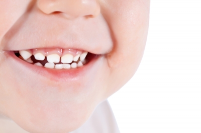 Quali sono i denti che si cambiano per primi nei bambini