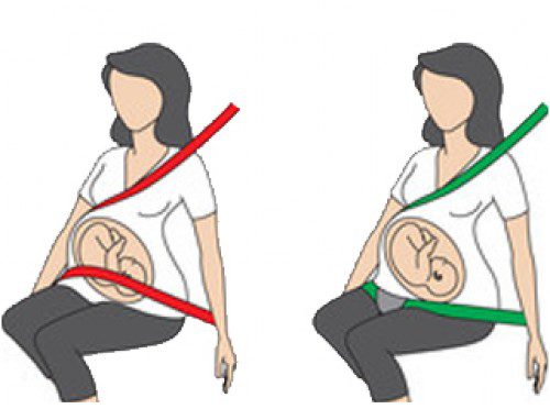 cintura sicurezza gravidanza