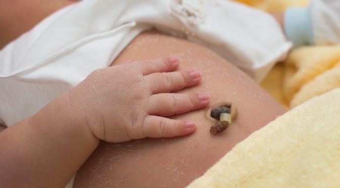 Guida pratica: Come disinfettare il cordone ombelicale del neonato
